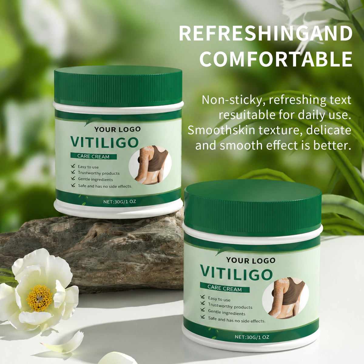 Vitiligo Herbal Aloe Vera & Mint Care Cream