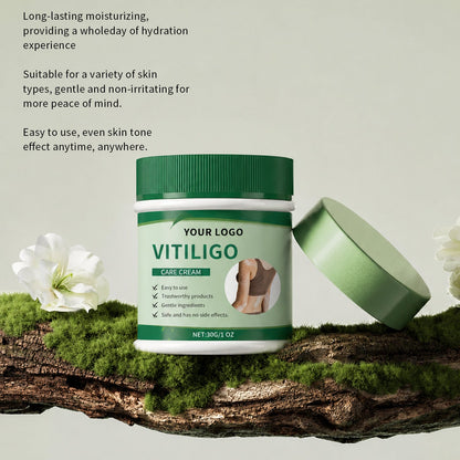 Vitiligo Herbal Aloe Vera & Mint Care Cream