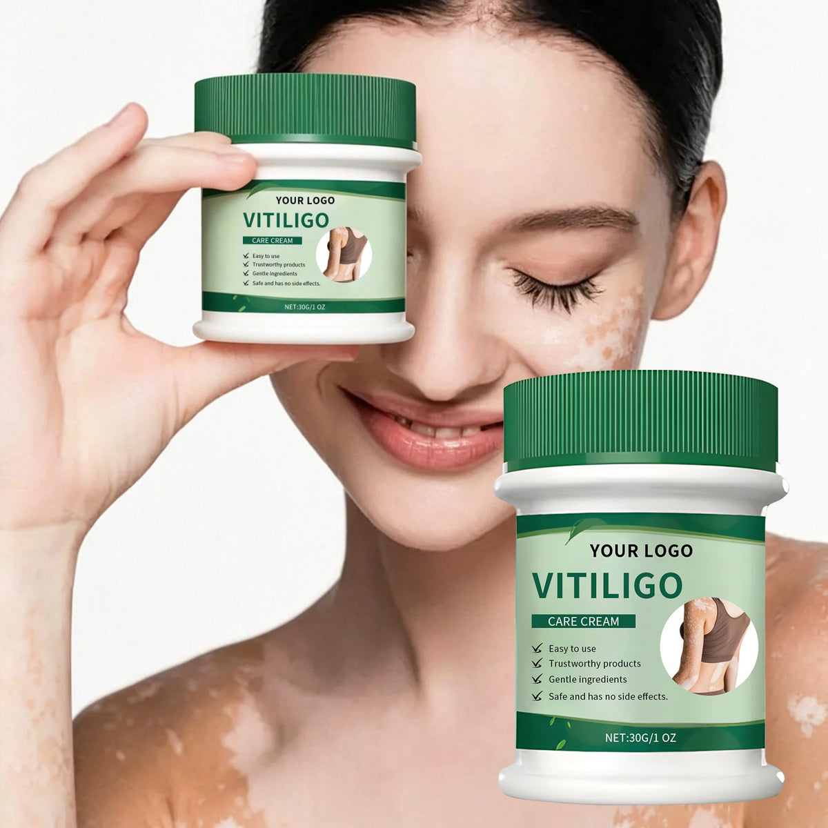 Vitiligo Herbal Aloe Vera & Mint Care Cream