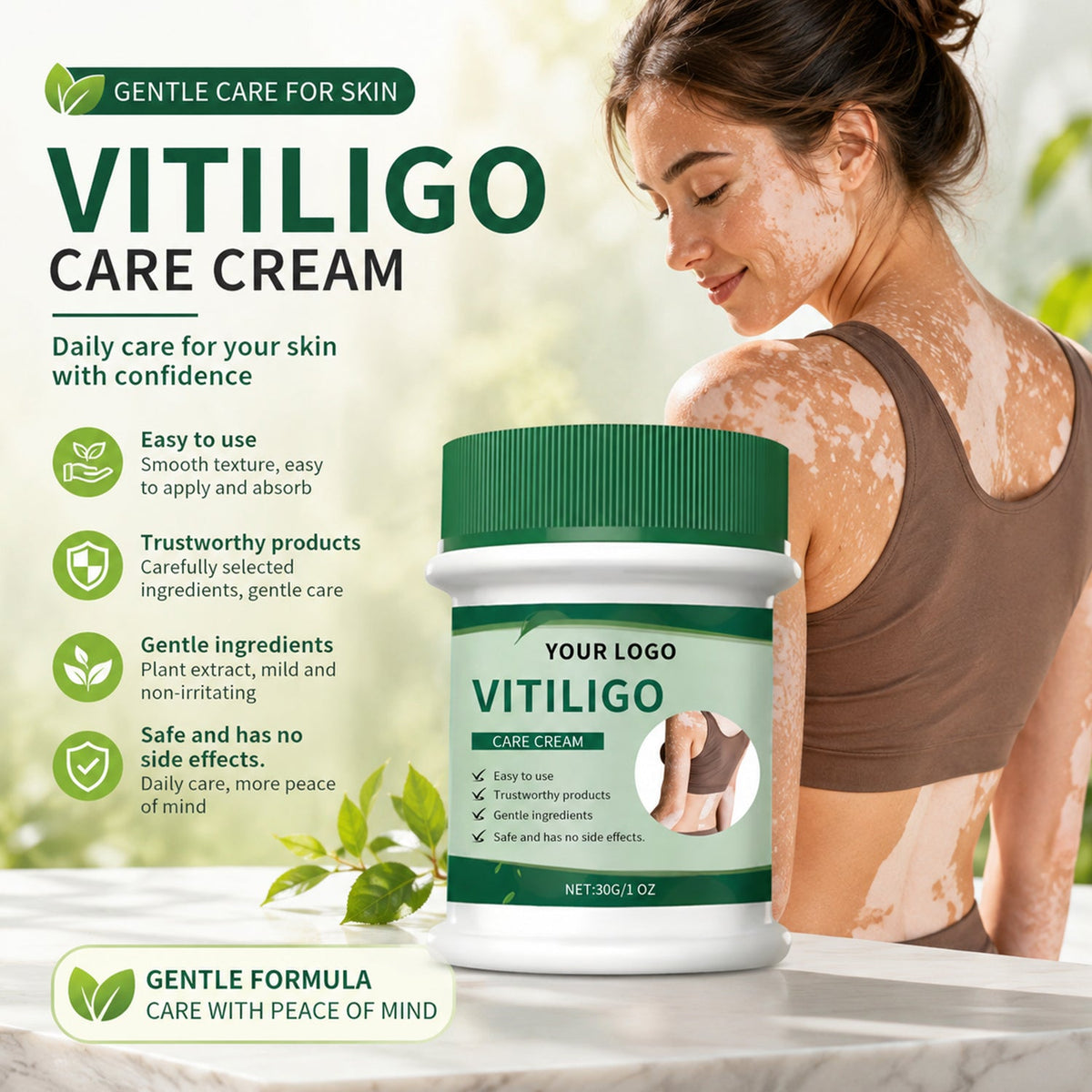 Vitiligo Herbal Aloe Vera & Mint Care Cream