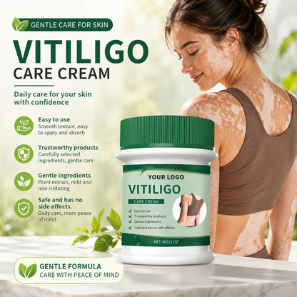 Vitiligo Herbal Aloe Vera & Mint Care Cream